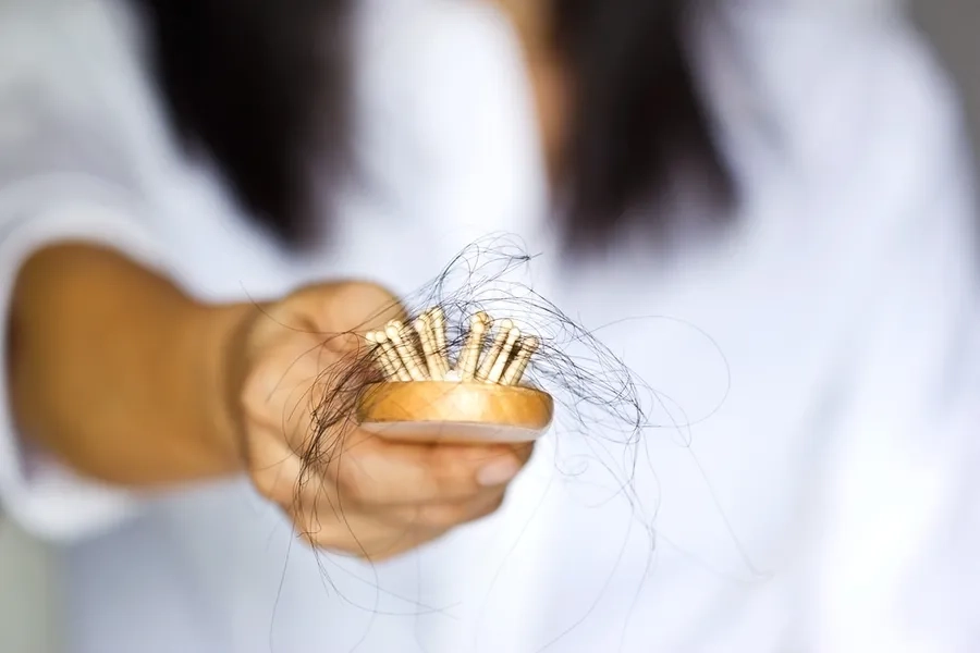 Treatment Options for Female Hair Loss: Exploring Effective Solutions